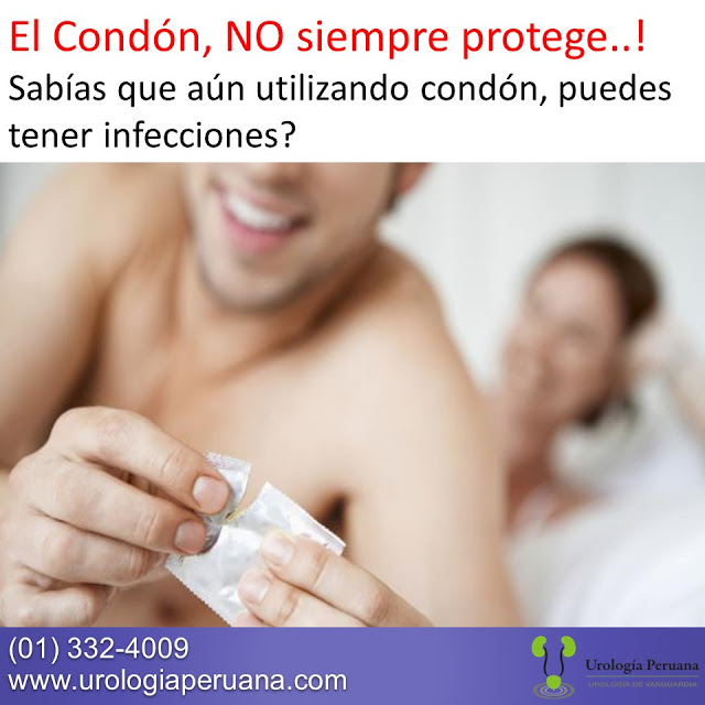 condon-no-protege-ets-papiloma-gonorrea-herpes