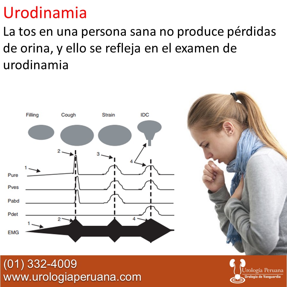 urodinamia-tos