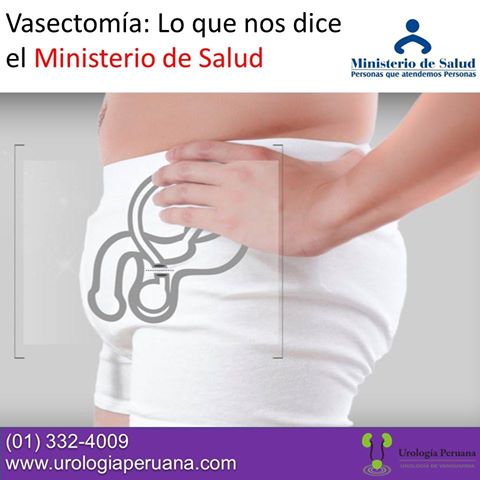vasectomia