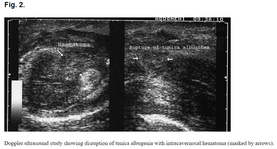 ScreenHunter_442 Sep. 11 16.36.jpg