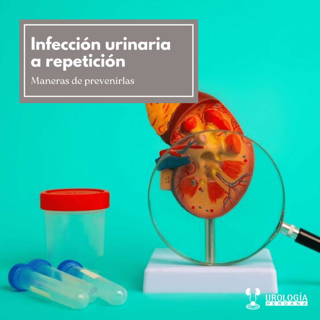 Infección urinaria a&nbsp;repetición