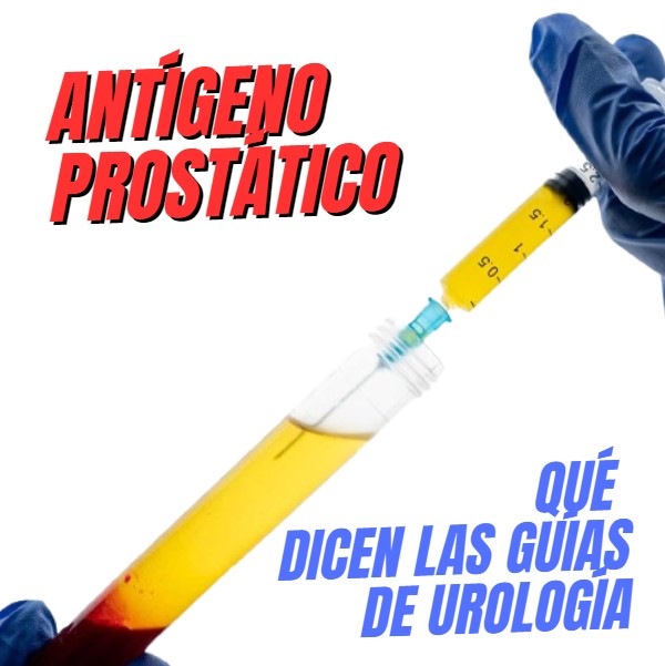 El PSA – antígeno prostástico específico – según las Guías de la Asociación Norteamericana de&nbsp;Urología.