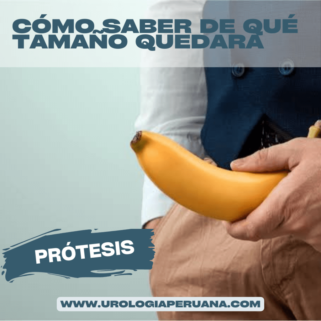 Cómo predecir el tamaño final del pene luego de una&nbsp;prótesis