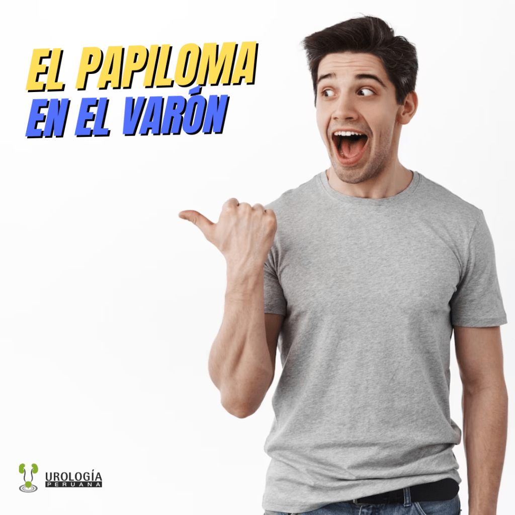 Papiloma, todo lo que debes&nbsp;saber.