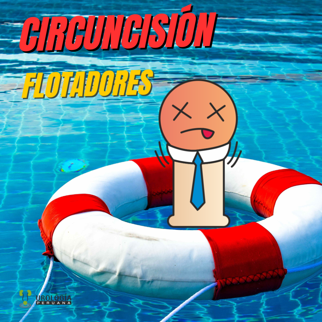 ¿Por qué aparecen «flotadores» después de una&nbsp;circuncisión?