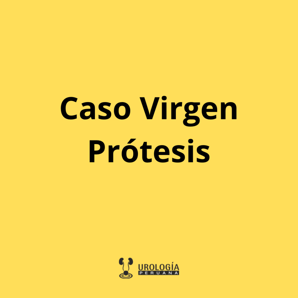 Prótesis, ¿qué es un caso&nbsp;virgen?