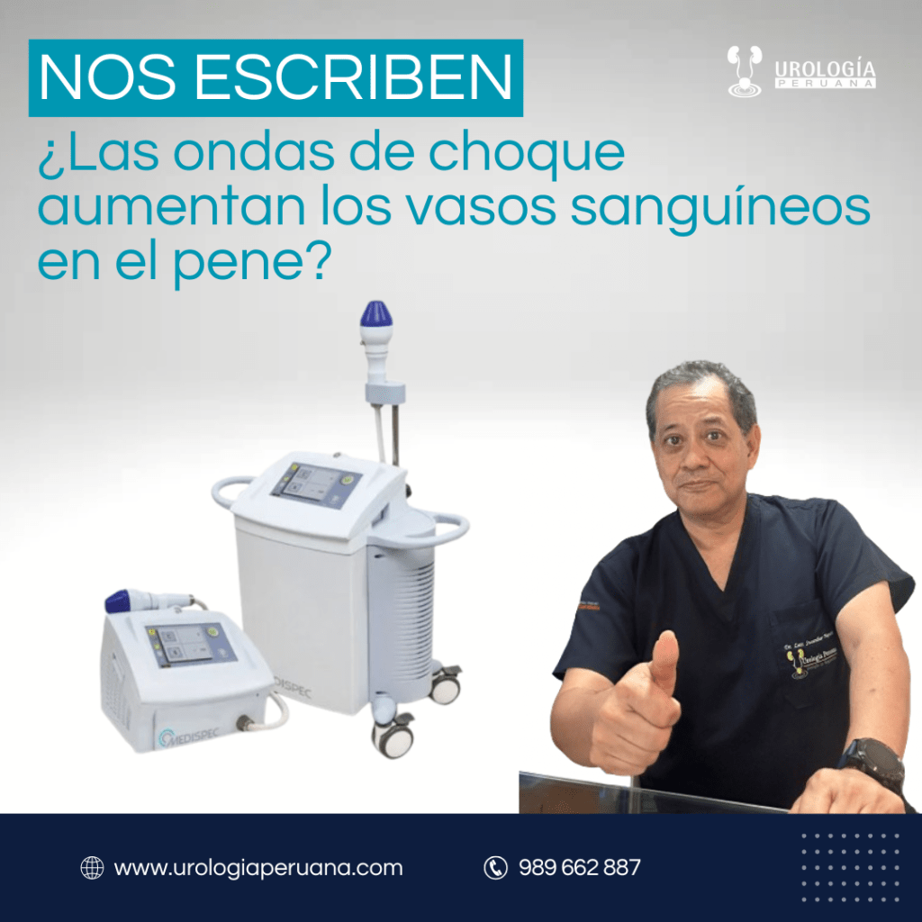 ¿Existe evidencia de que las ondas de choque aumenten los vasos sanguíneos en el pene?