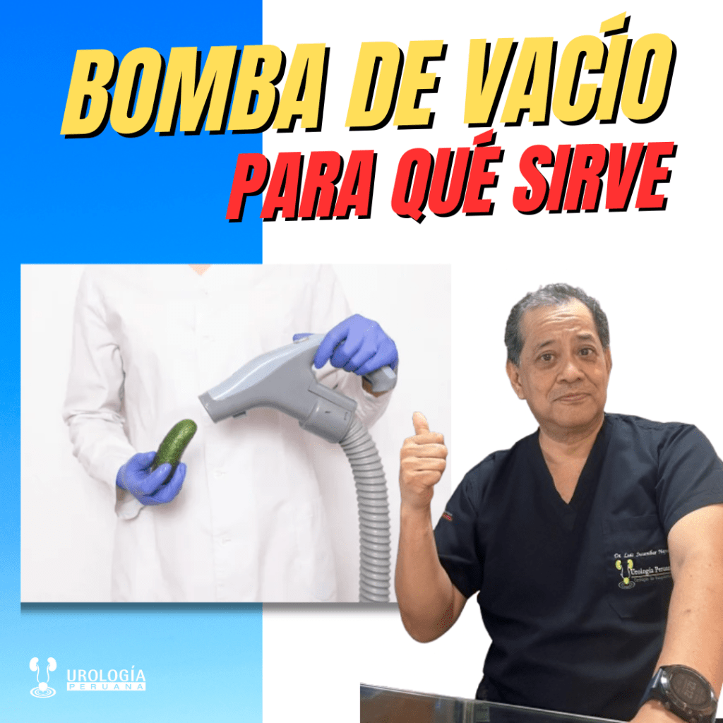 Rol de la bomba de vacío