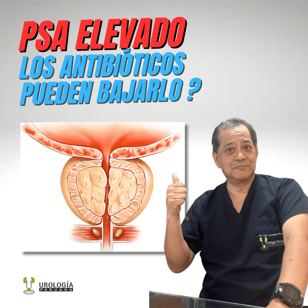 Usar antibióticos puede disminuir el antígeno prostático. Lo que dice la&nbsp;ciencia