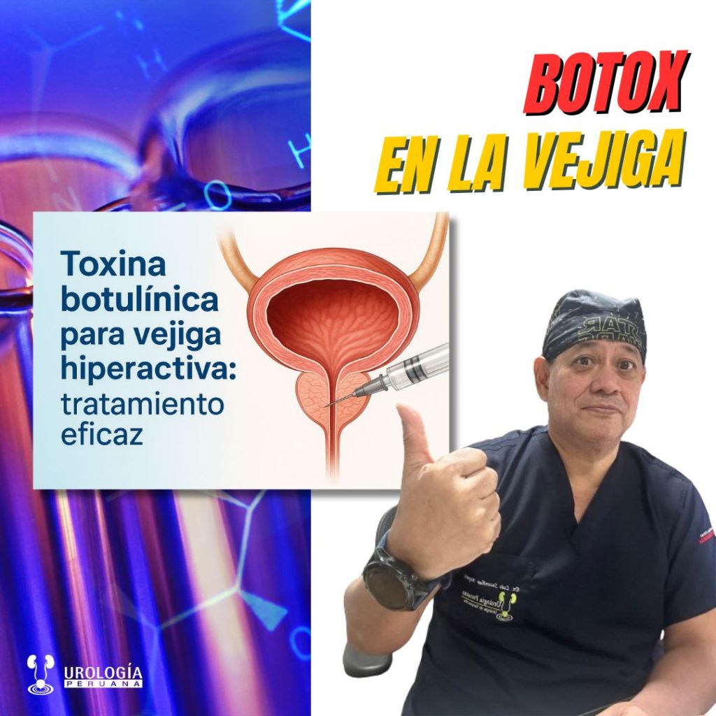 Toxina botulínica para vejiga hiperactiva: tratamiento&nbsp;eficaz