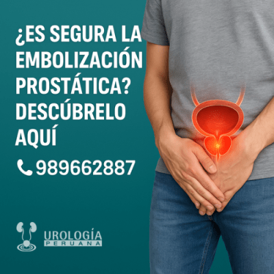 Embolización prostática: opción para próstata&nbsp;grande