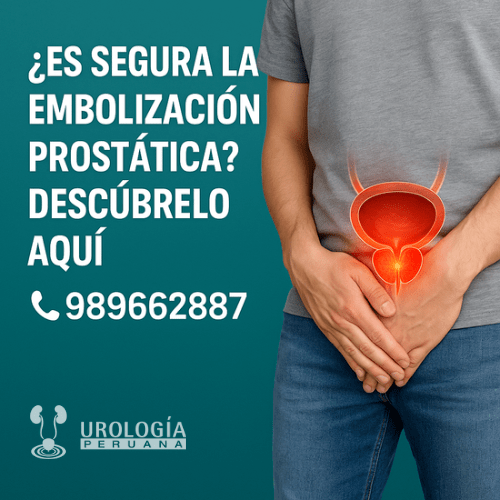 Embolización prostática: opción para próstata&nbsp;grande