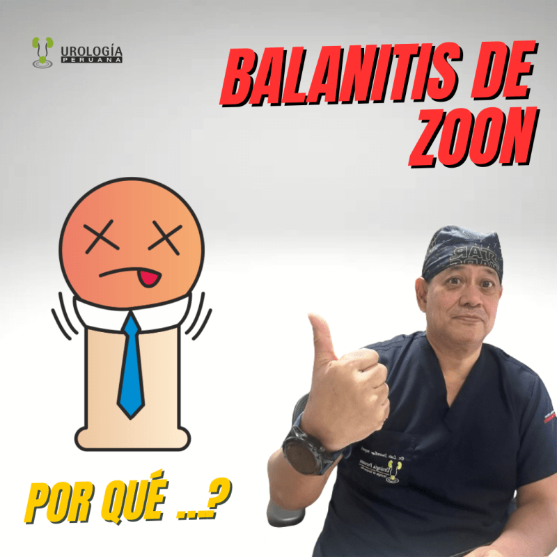 Tratamiento de la balanitis de Zoon: opciones médicas y&nbsp;cirugía