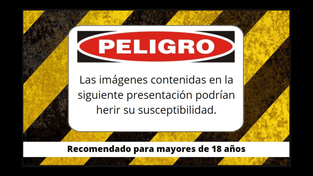 Protegido: Fractura peniana;&nbsp;fotos