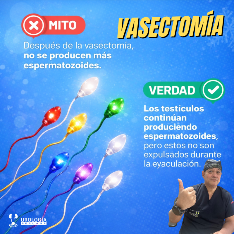 Qué sucede con los espermatozoides luego de una&nbsp;vasectomía
