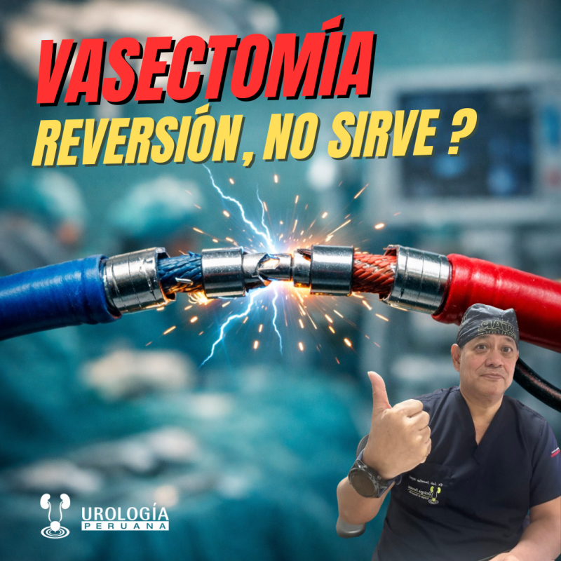 La reversión de la vasectomía no&nbsp;sirve