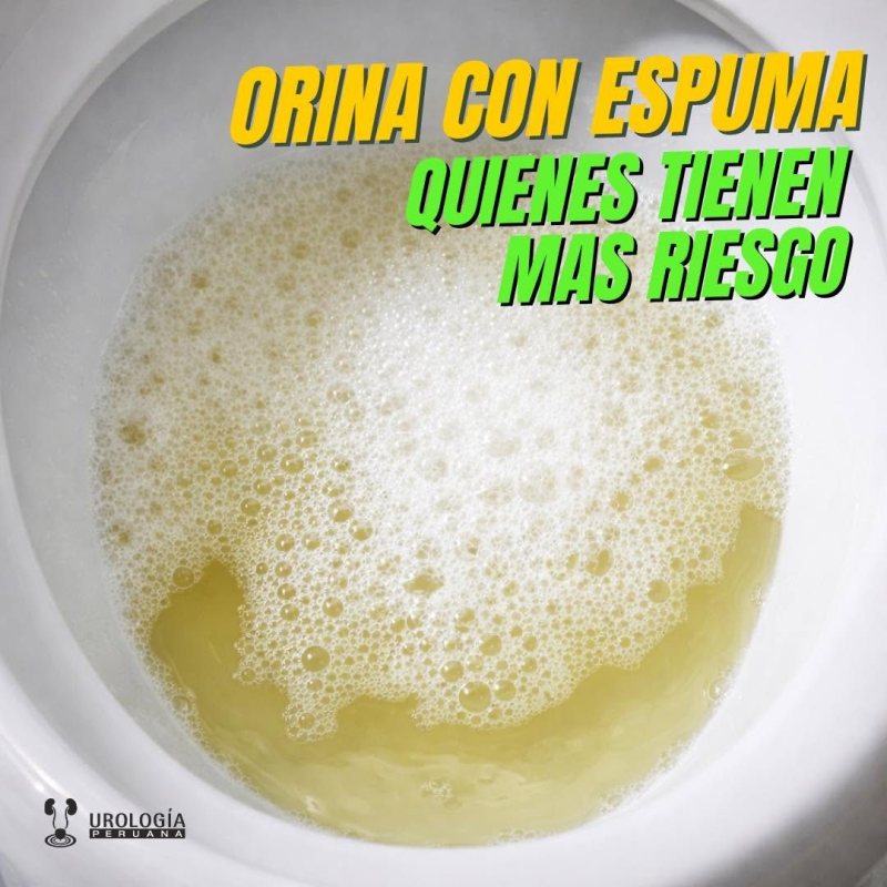 Orina con espuma, ¿quienes la&nbsp;tienen?