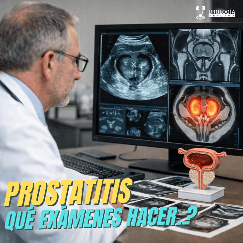 Cómo evaluar la&nbsp;prostatitis