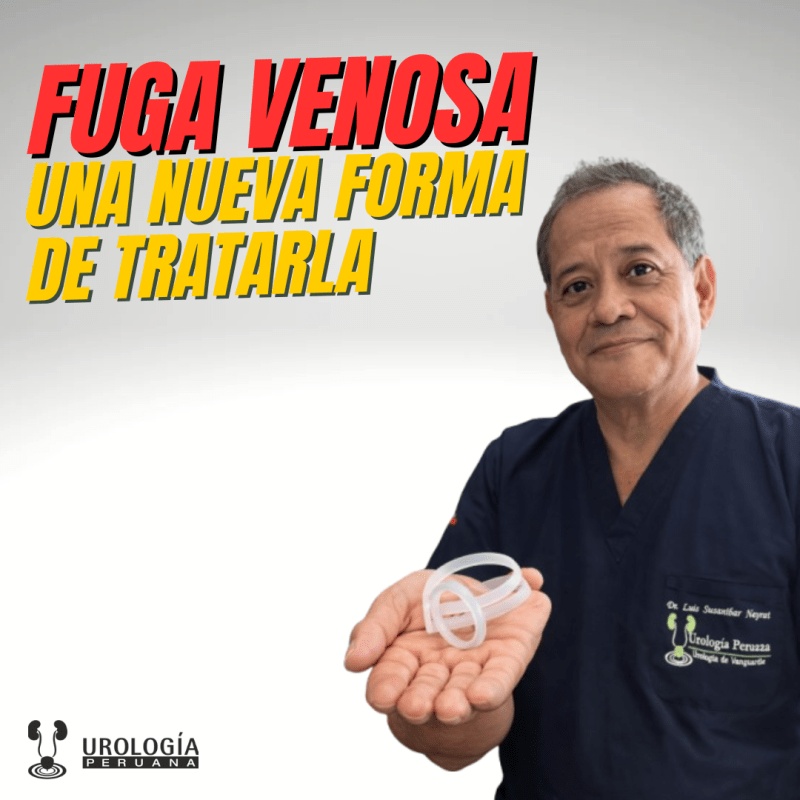 Nueva forma de tratar la fuga venosa y la Disfunción&nbsp;Eréctil