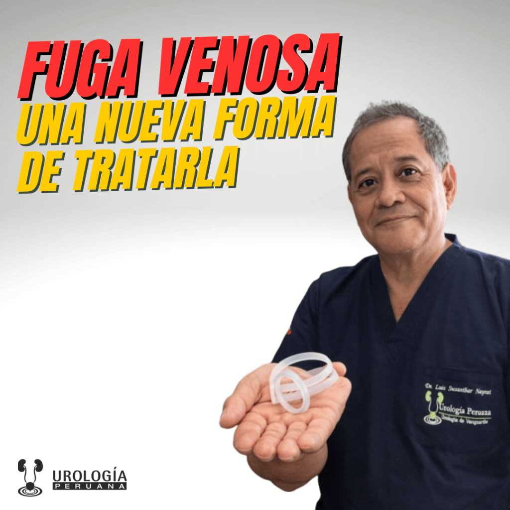 Nueva forma de tratar la fuga venosa y la Disfunción&nbsp;Eréctil