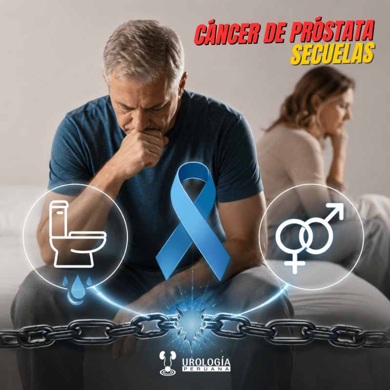 Secuelas urinarias y sexuales tras la prostatectomía&nbsp;radical